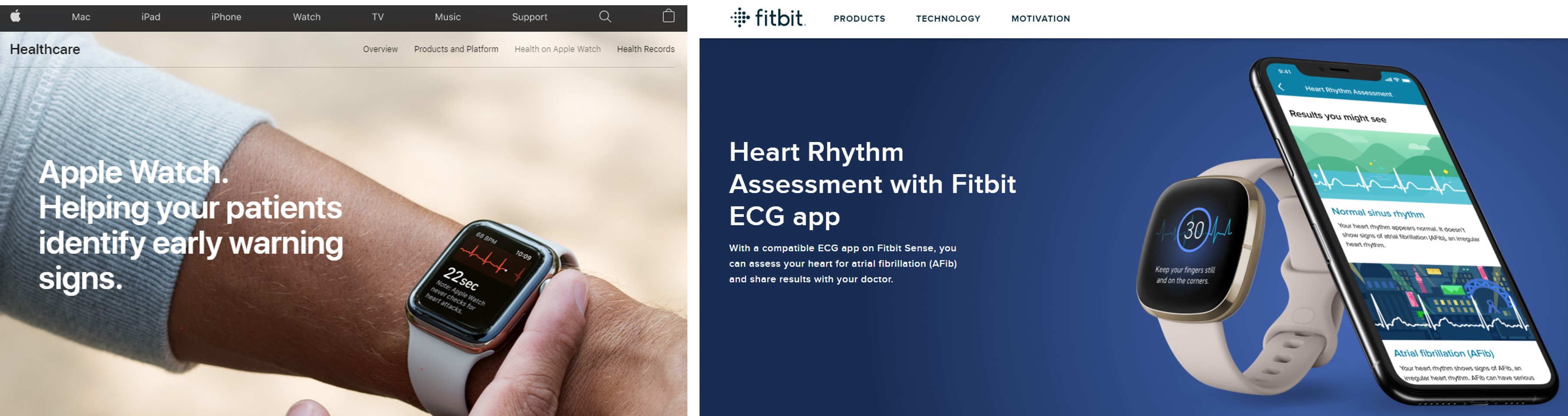Heart Rate Measurement from ECG — ecgwatch